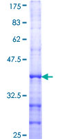 12.5% SDS-PAGE Stained with Coomassie Blue.